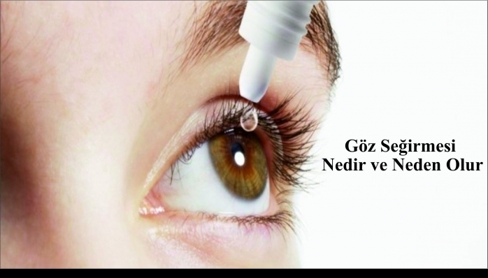 Göz Seğirmesi  Nedir ve Neden Olur