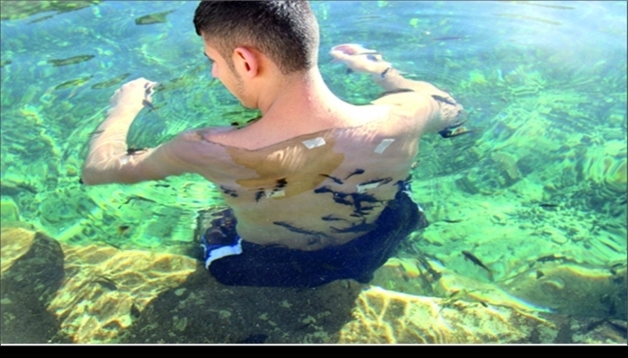 Sivas Valiliği  Balıklı Kaplıca’da Sahaya İndi